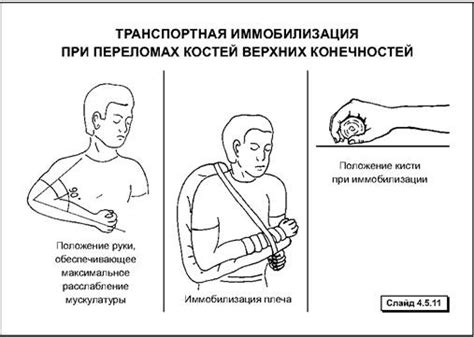 Правила безопасности при тренировках с эластичным бинтом