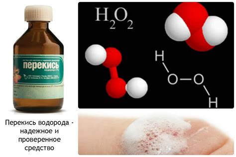 Правила применения перекиси водорода при обработке ран