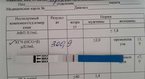 Правила сдачи крови на ХГЧ при приеме Дюфастона