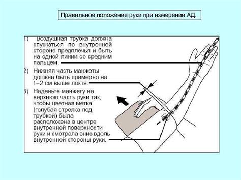Правильное наложение манжеты на пациента