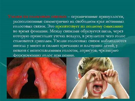 Правильное питание и вода для поддержания голосовых связок в идеальной форме