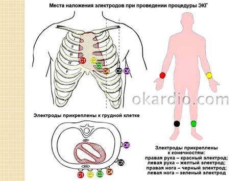 Правильное подключение и установка ЭКГ-аппарата