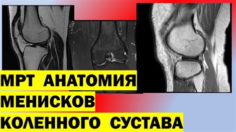 Предотвращение горения внутри колена