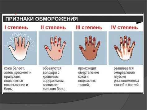 Предотвращение обморожения и проникновения инфекций через ноги