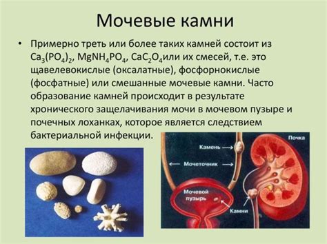 Предупреждение образования камней в организме