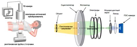 Преимущества безопасного рентгеновского исследования