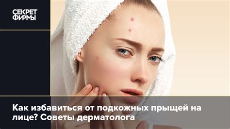 Преимущества и недостатки прижигания подкожных прыщей йодом