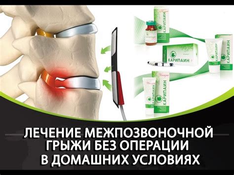 Преимущества натурального лечения грыжи