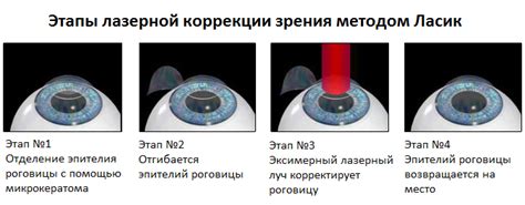 Преимущества правильной коррекции зрения