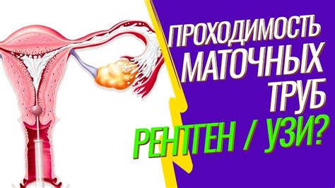 Преимущества регулярного проведения ГСГ