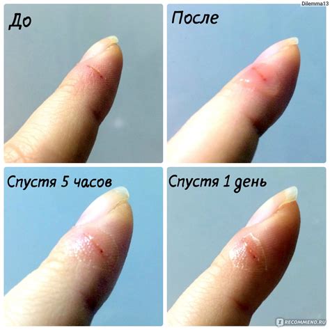 Применение клея БФ 6 Вертекс