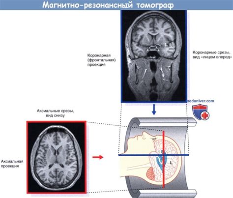 Принципы работы томографии мозга