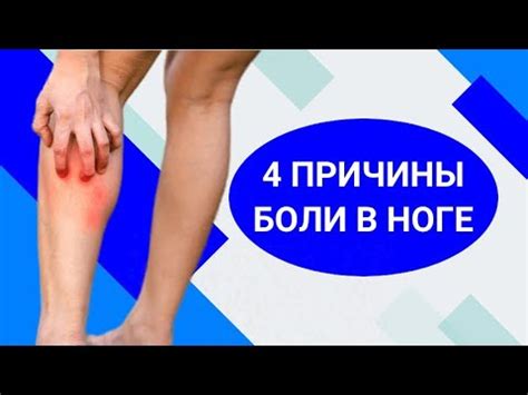 Причины боли в ногах