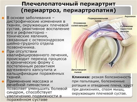 Причины боли в плечевых суставах у женщин после 40 и способы лечения