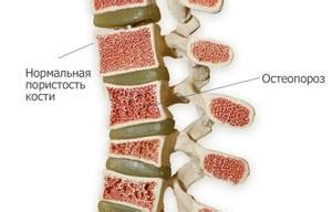Причины боли в пояснице после травмы