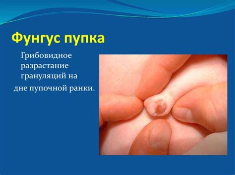 Причины взгляда новорожденного вверх