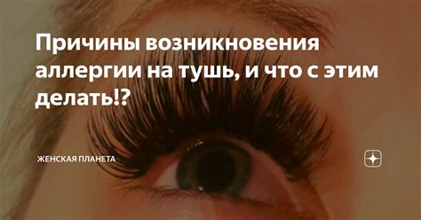 Причины возникновения аллергии