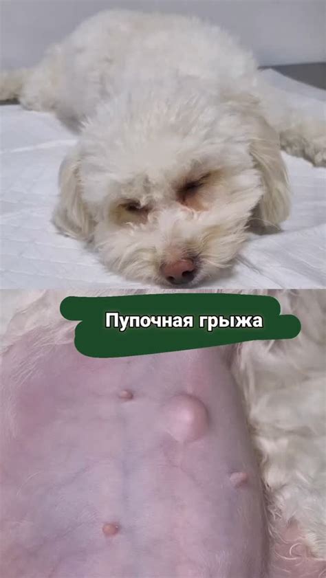 Причины возникновения пупочной грыжи