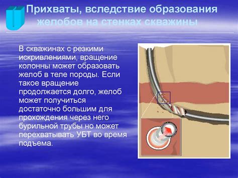 Причины газовых выделений