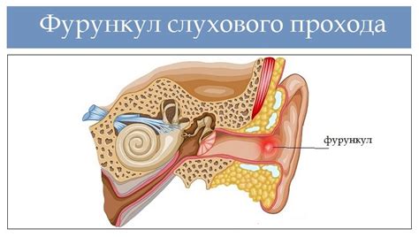 Причины звуков в ухе от ракушки