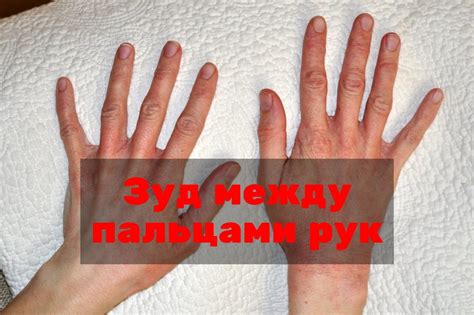 Причины зуда между пальцами на руках