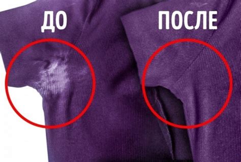 Причины и последствия пятна на одежде