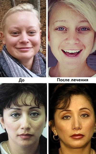 Причины краснения лица при наклоне вниз