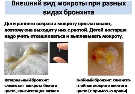 Причины кровотечения из горла