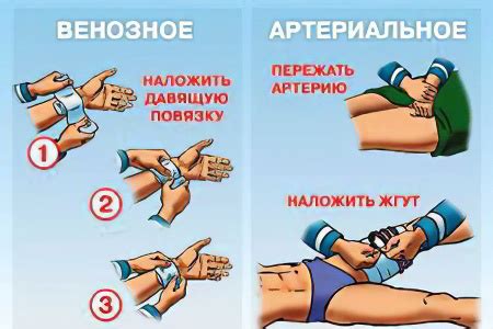 Причины кровотечения при приеме воды