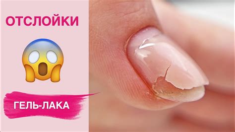 Причины отслойки геля на ногтях
