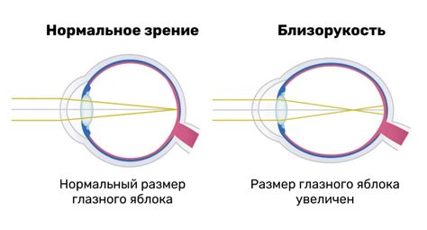 Причины отсутствия щипания глаз при образовании слез