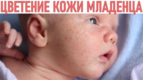 Причины повышенной потребности кожи младенца в уходе в летнее время