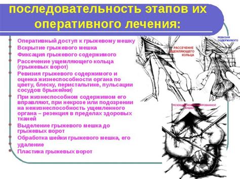 Причины появления бобовидных грыж