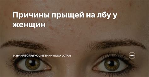 Причины появления прыщей на лбу осенью