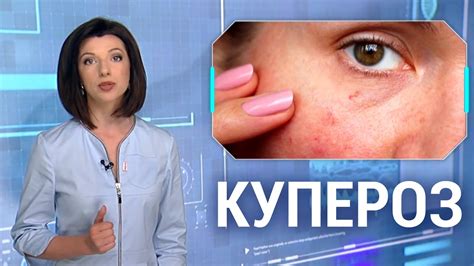 Причины появления сетки сосудистых структур на лице
