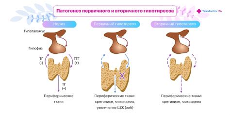 Причины развития заболеваний щитовидной железы