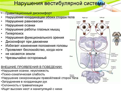 Причины слабого вестибулярного аппарата