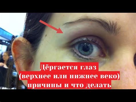 Причины слезления левого глаза