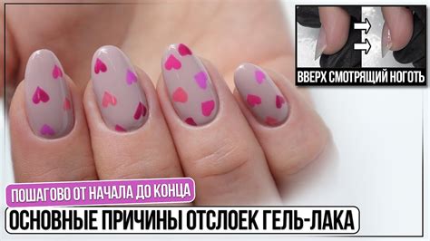 Причины удаления гель-лака