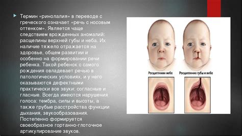 Причины формирования у ребенка волчьей пасти
