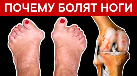 При повышении температуры: причина болей в ногах