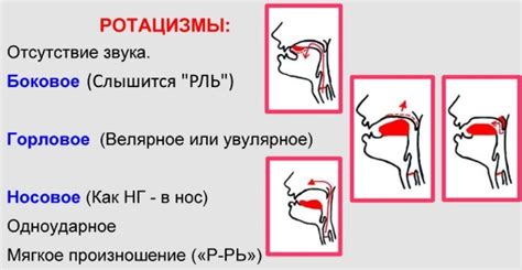 Проблемы при произношении мягкого звука