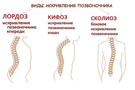 Проблемы с позвоночником и нервной системой