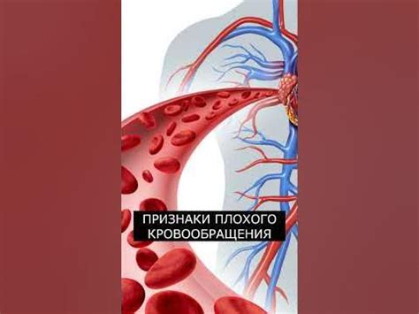 Проблемы с циркуляцией и кровообращением