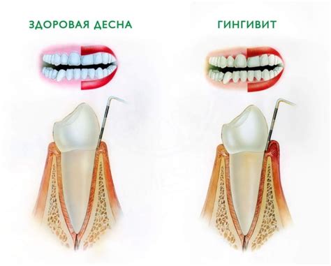 Проверка состояния зубов и десен