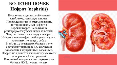 Простатит как расстройство мочевой системы
