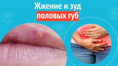 Простые способы облегчить зуд половых губ навсегда!