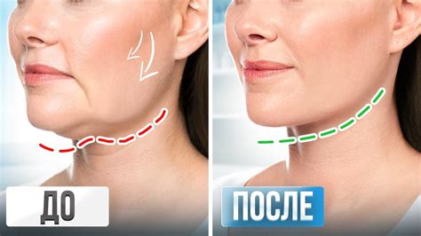 Простые упражнения для лица: массаж и разминка для мгновенного улучшения состояния