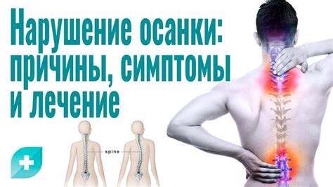 Профилактика и поддержание осанки в повседневной жизни