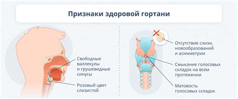 Профилактика и способы предотвращения осиплости